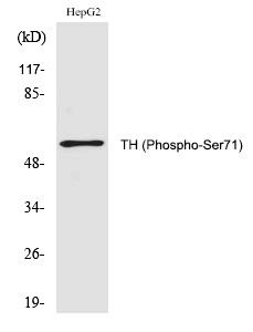 Anti-Phospho-TH (Ser71) Polyclonal Antibody