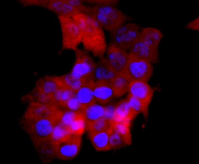 Anti-SOD1 Antibody (4Y683)