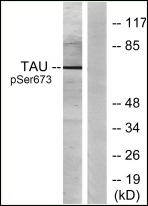Anti-Phospho-MAPT (Ser673) Polyclonal Antibody