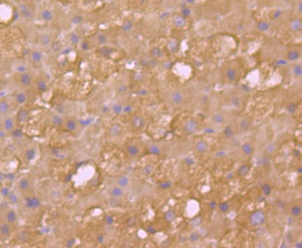 Anti-SULT2A1 Antibody (1I505)
