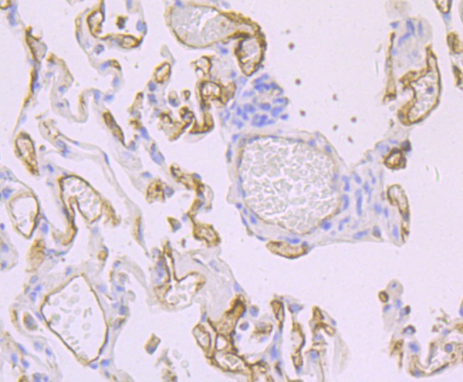 Anti-Thrombomodulin Antibody (5U850)