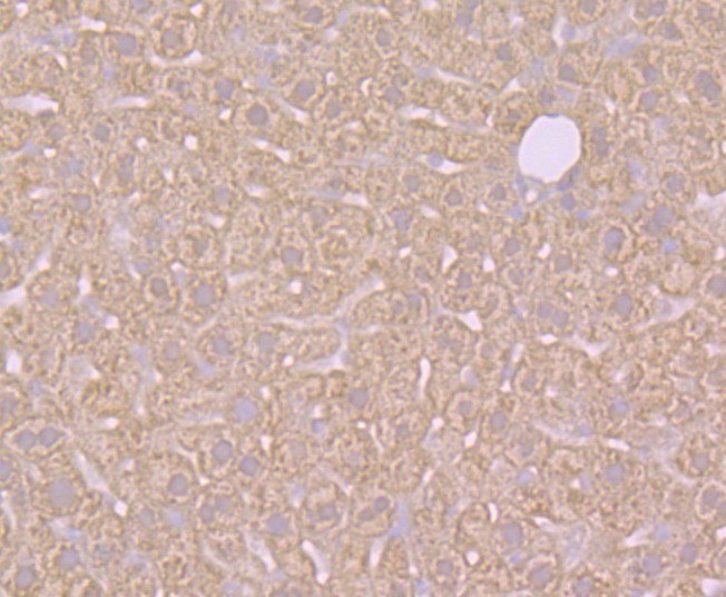 Anti-SULT2A1 Antibody (1I505)