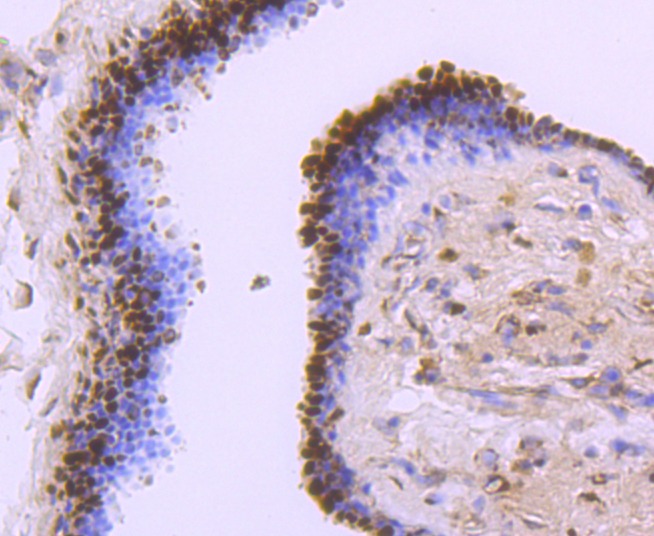 Anti-SOD1 Antibody (4Y683)