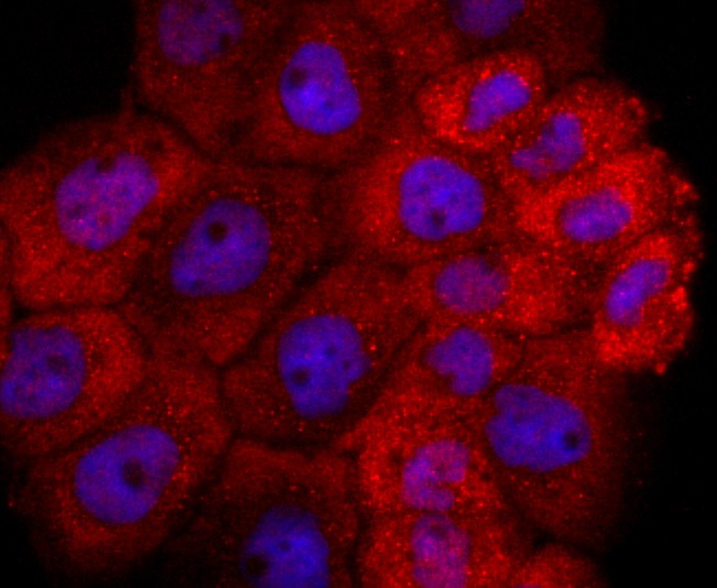 Anti-TIA1 Antibody (9Q940)