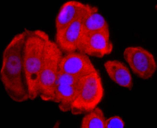 Anti-Thioredoxin/TRX Antibody (5F422)