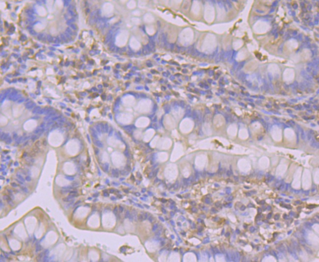 Anti-SULT2A1 Antibody (1I505)