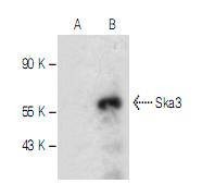 Anti-SKA3 Antibody (3K426)