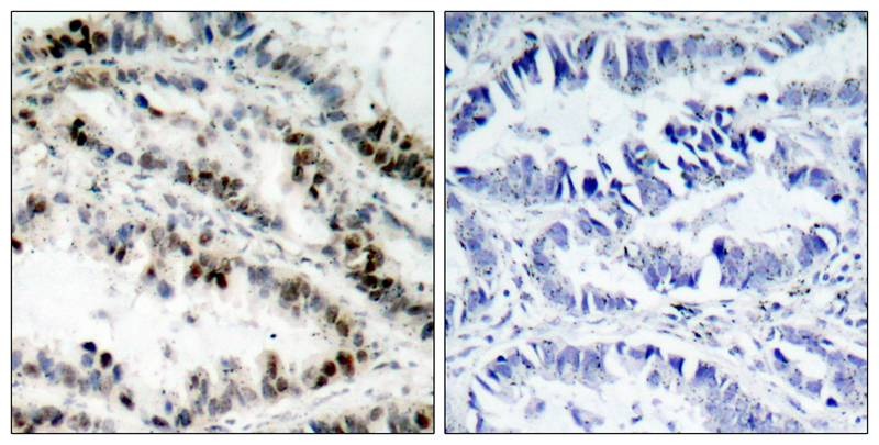 Anti-Phospho-SMC1A (Ser957) Polyclonal Antibody
