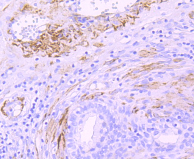 Anti-smooth muscle Myosin heavy chain 11 Antibody (7J784)