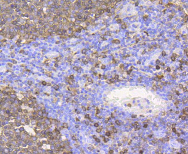 Anti-Stathmin 1 Antibody (2X10)