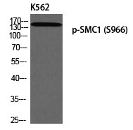 Anti-Phospho-SMC1A (Ser966) Polyclonal Antibody