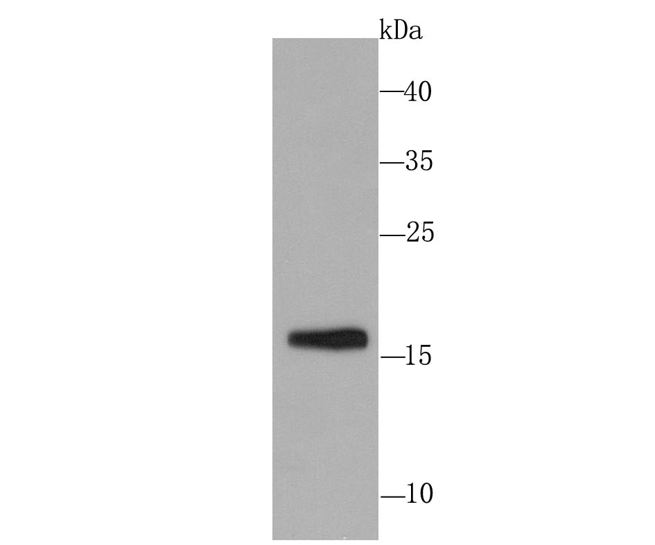 Anti-SKP1 Antibody (9W207)