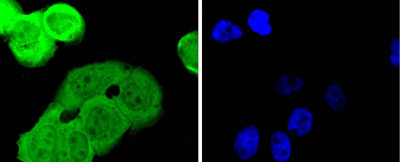 Anti-SMAD1 Antibody (1C774)
