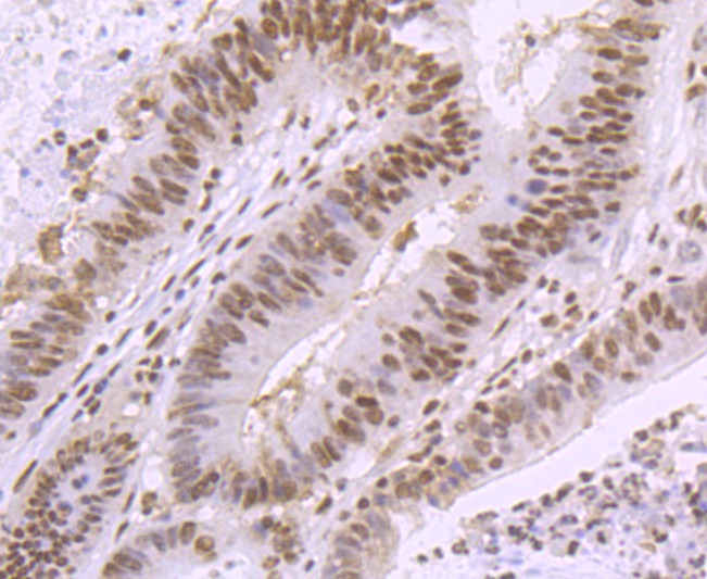 Anti-SMC3 Antibody (2D413)