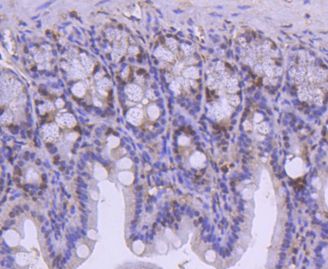 Anti-SMC1A Antibody (7H408)