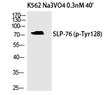 Anti-Phospho-SLP-76 (Tyr128) Polyclonal Antibody