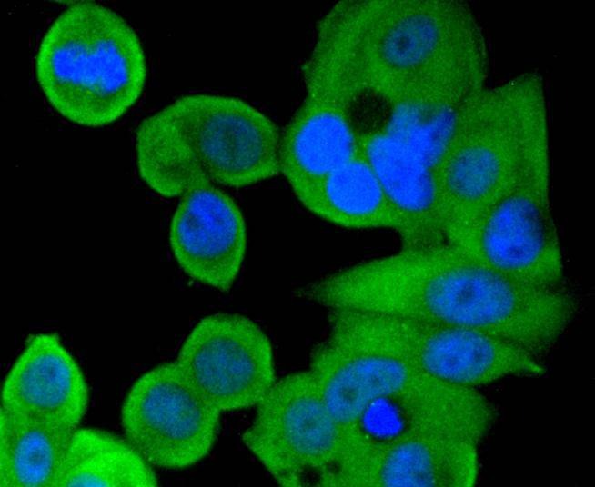 Anti-SMAD1 Antibody (1C774)