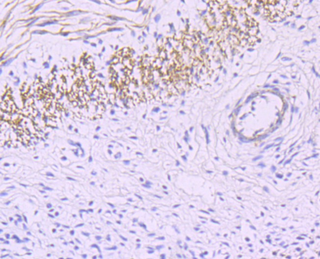 Anti-smooth muscle Myosin heavy chain 11 Antibody (7J784)