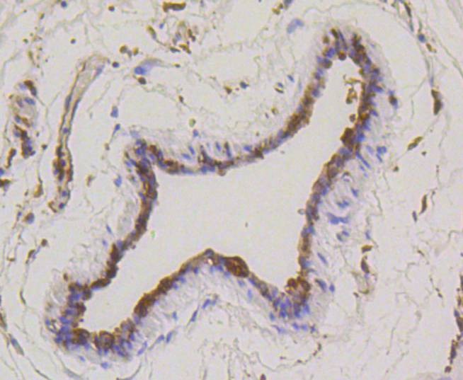 Anti-Stathmin 1 Antibody (2X10)