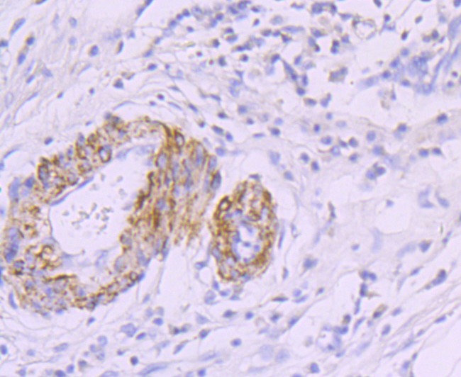 Anti-smooth muscle Myosin heavy chain 11 Antibody (7J784)