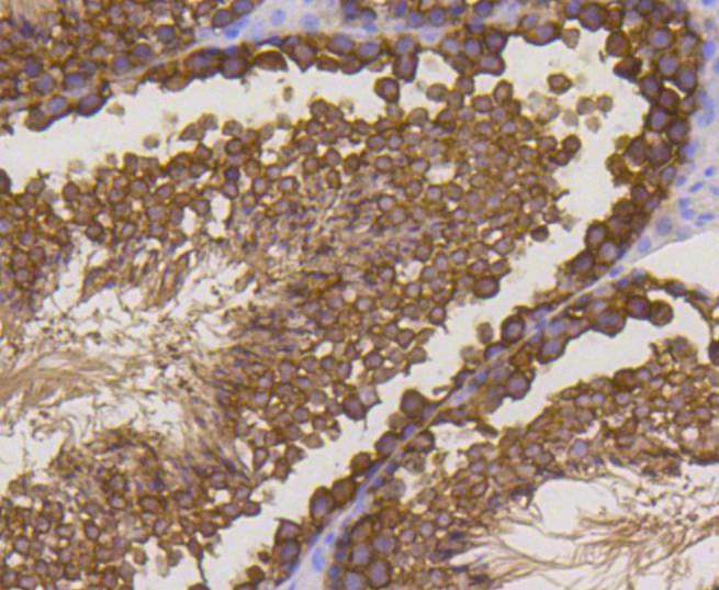 Anti-Stathmin 1 Antibody (2X10)