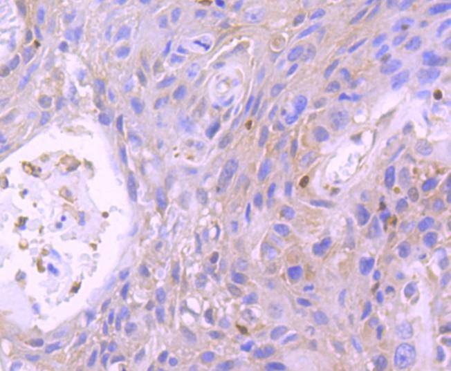 Anti-STAT5B Antibody (1Y166)