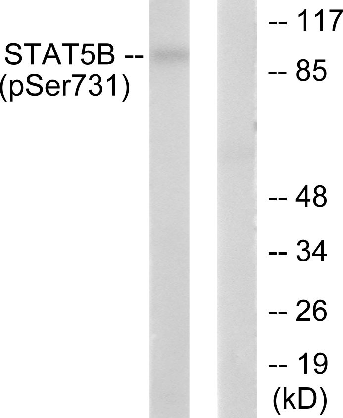 Anti-Phospho-STAT5B (Ser731) Polyclonal Antibody