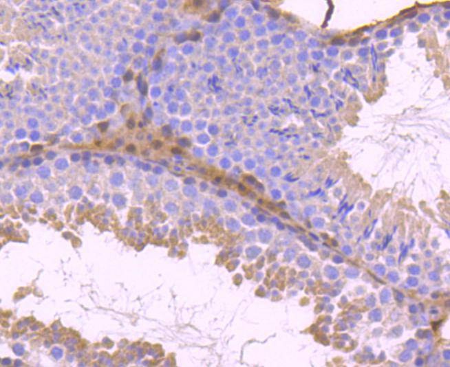 Anti-STAT5B Antibody (1Y166)