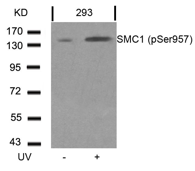 Anti-Phospho-SMC1A (Ser957) Polyclonal Antibody