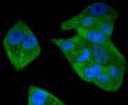 Anti-STAT5B Antibody (1Y166)