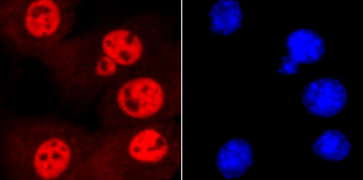 Anti-SMC3 Antibody (2D413)