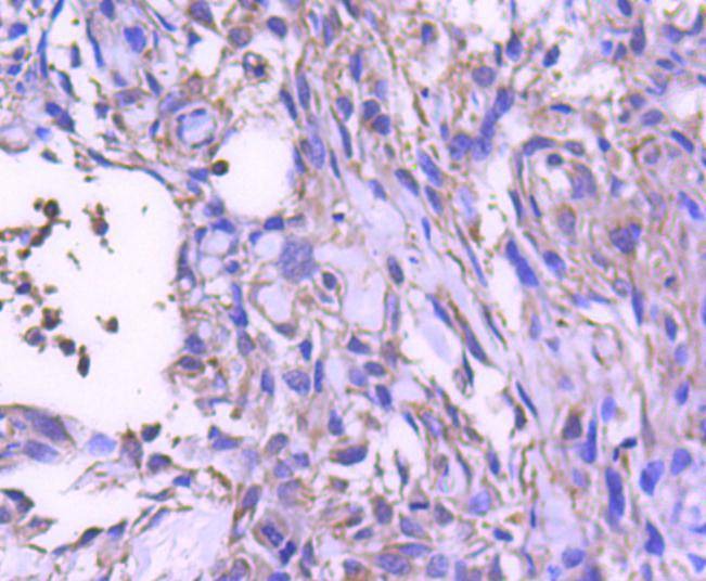 Anti-STAT6 Antibody (8C359)
