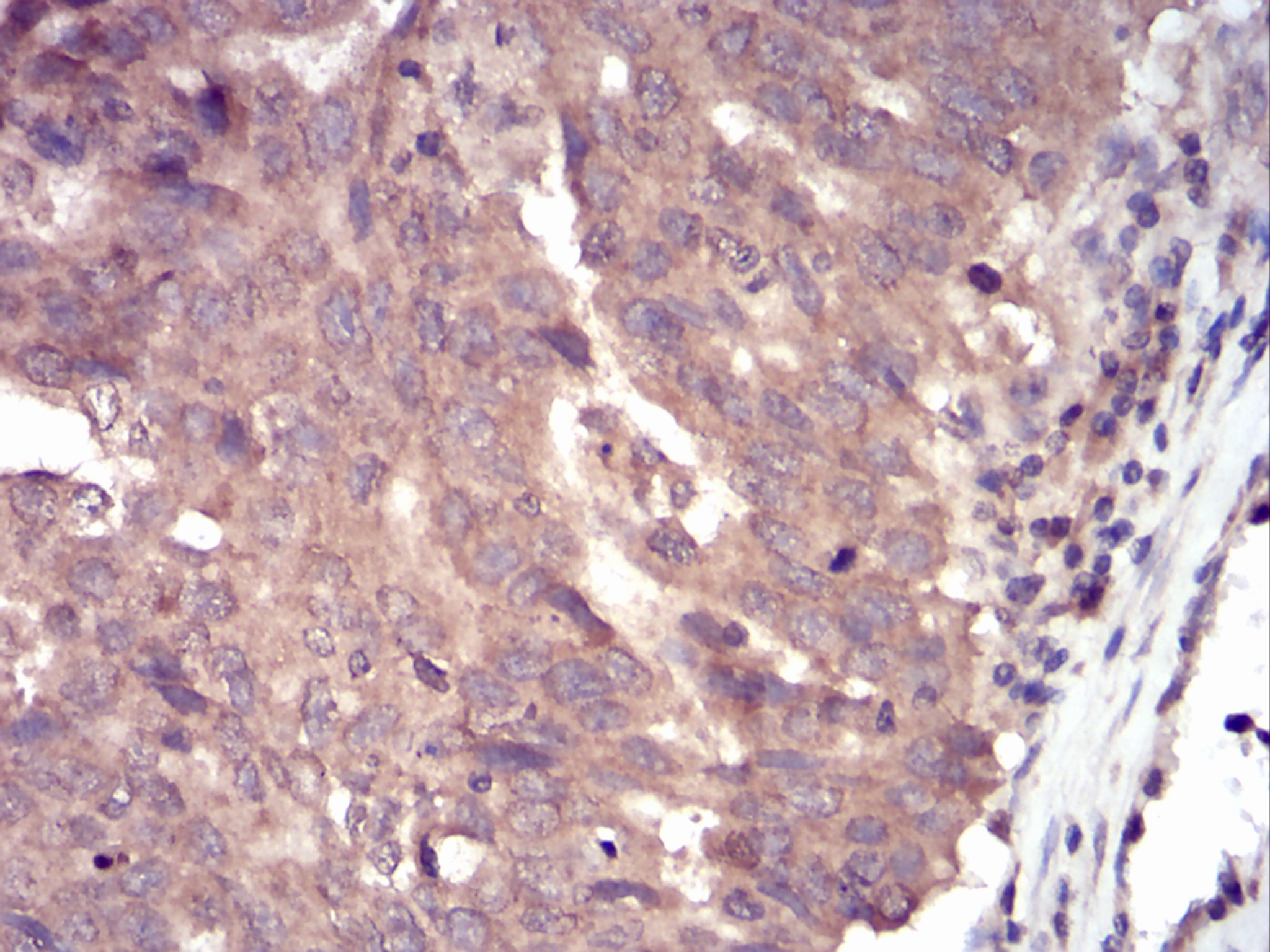 Anti-SLINGSHOT-1L Antibody (4Y112)