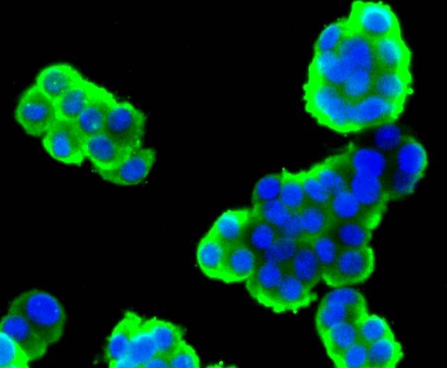 Anti-Stathmin 1 Antibody (2X10)