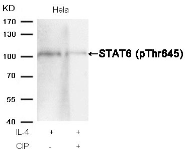 Anti-Phospho-STAT6 (Thr645) Polyclonal Antibody