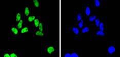 Anti-SMC1A Antibody (7H408)