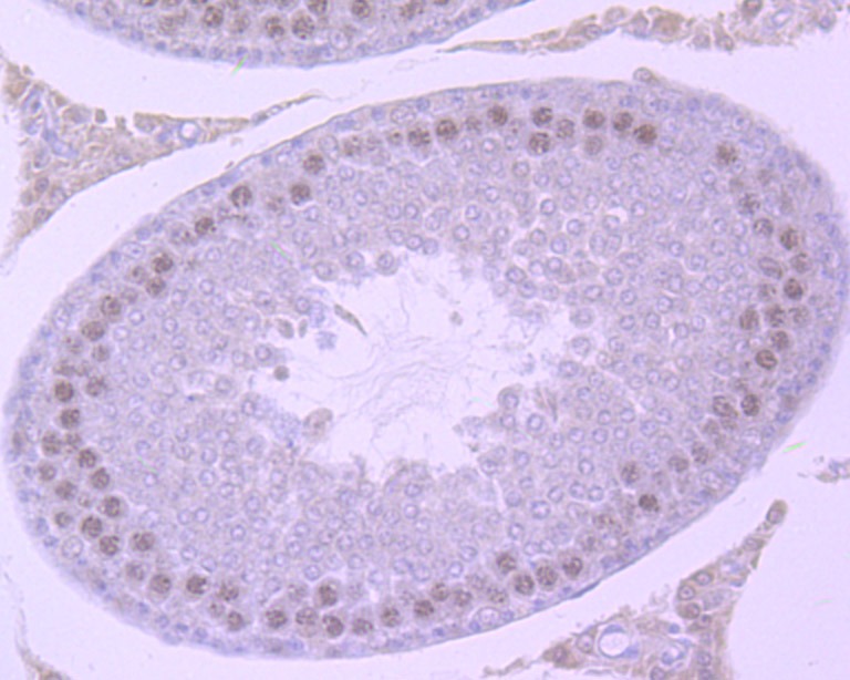 Anti-SMARCC1 Antibody (6J524)