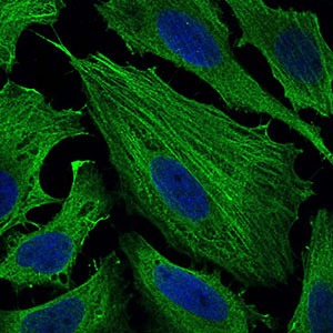 Anti-SMCP Antibody (3I511)
