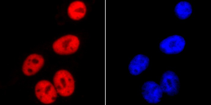 Anti-SMC3 Antibody (2D413)