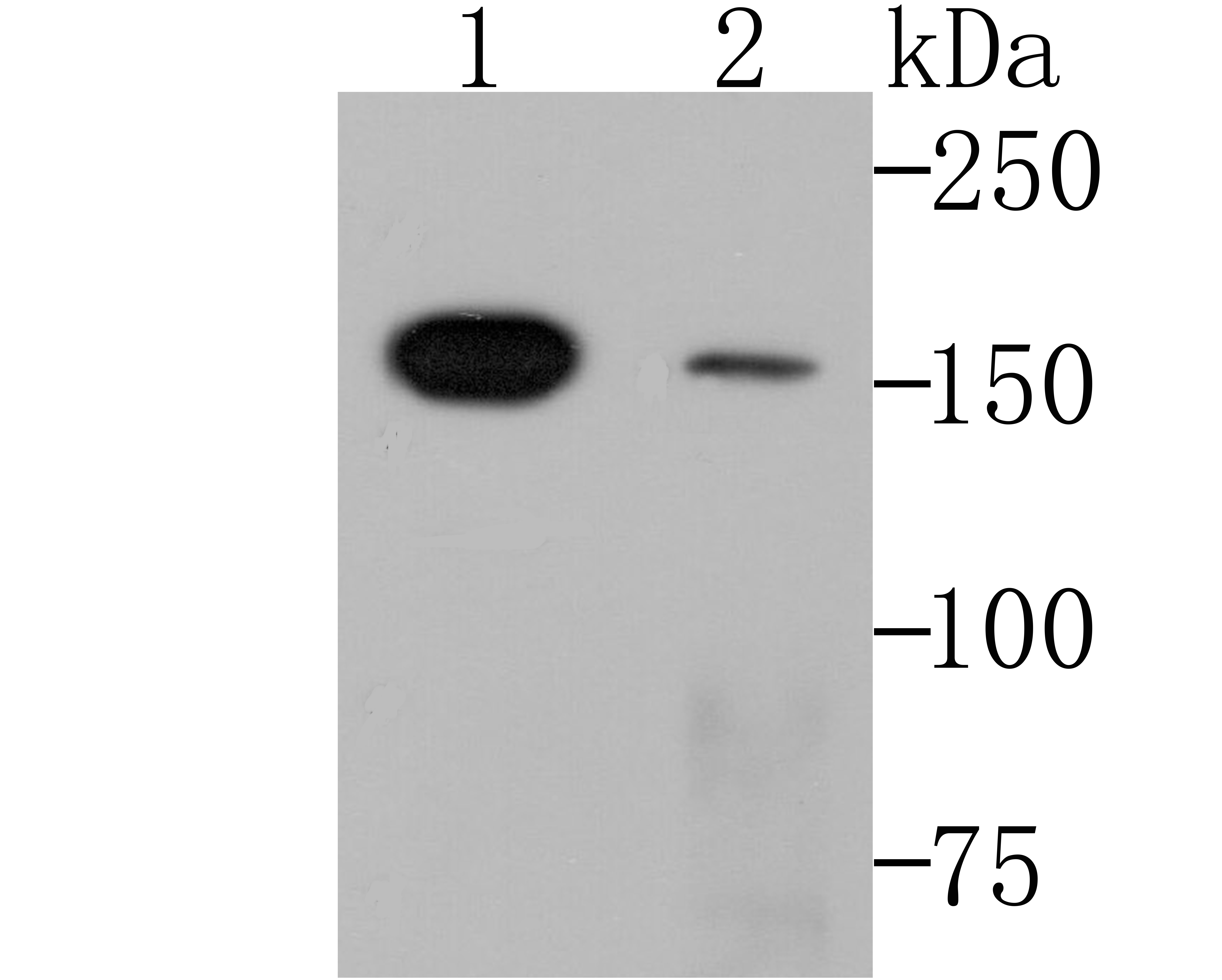 Anti-SMARCC1 Antibody (6J524)