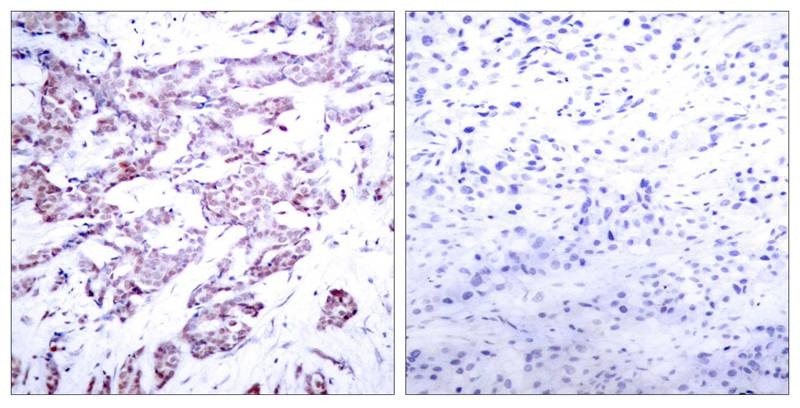 Anti-Phospho-STAT6 (Thr645) Polyclonal Antibody