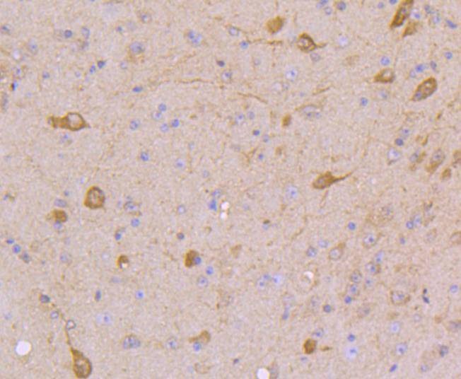 Anti-STAT5A/B Antibody (8D628)