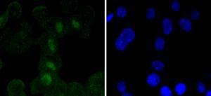 Anti-SOX11 Antibody (4S363)