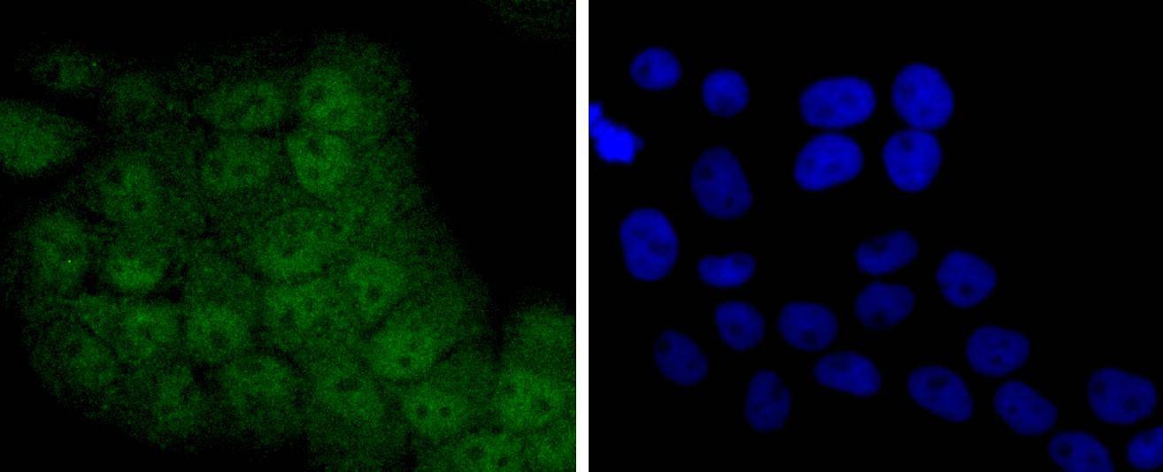 Anti-STAT5A/B Antibody (8D628)