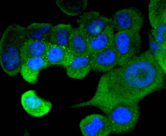 Anti-STAT1 Antibody (5F189)