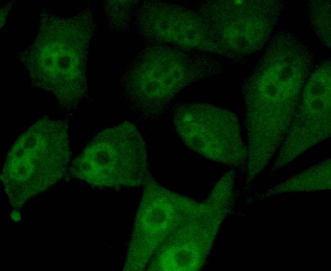 Anti-SMAD5 Antibody (9J928)