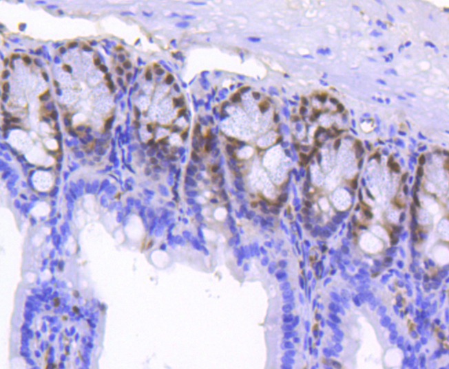Anti-SOX9 Antibody (7W835)