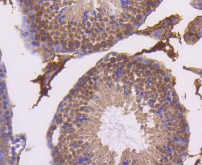 Anti-SMAD5 Antibody (9J928)