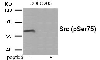 Anti-Phospho-Src (Ser75) Polyclonal Antibody