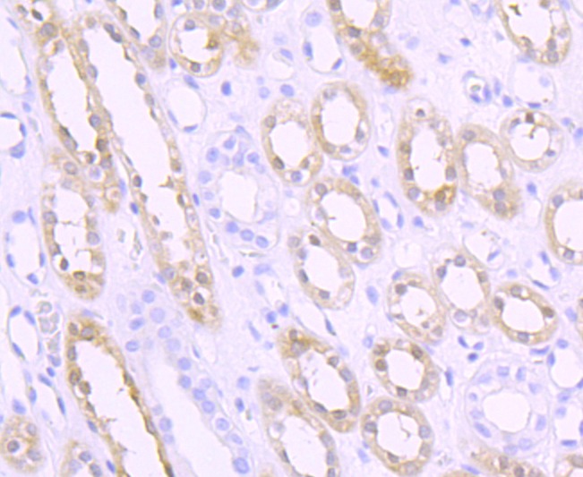 Anti-Sphingosine Kinase 1/SPHK1 Antibody (6L121)
